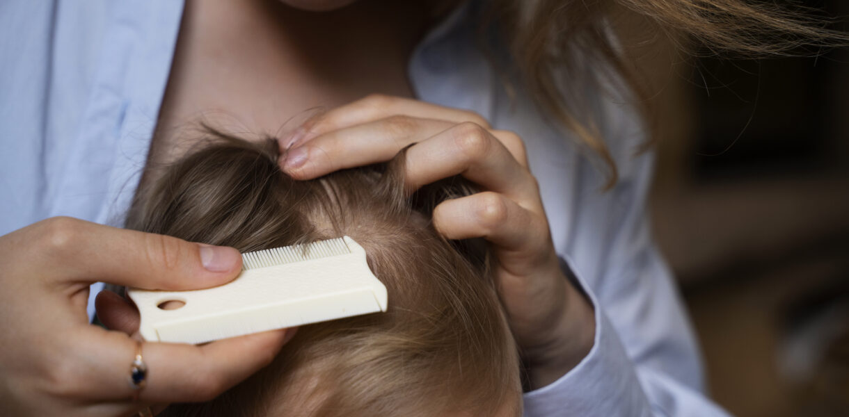 Odparzenia u niemowląt – skuteczna profilaktyka i leczenie krok po kroku