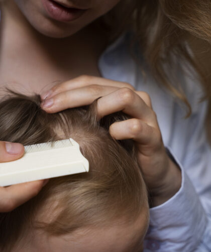 Odparzenia u niemowląt – skuteczna profilaktyka i leczenie krok po kroku